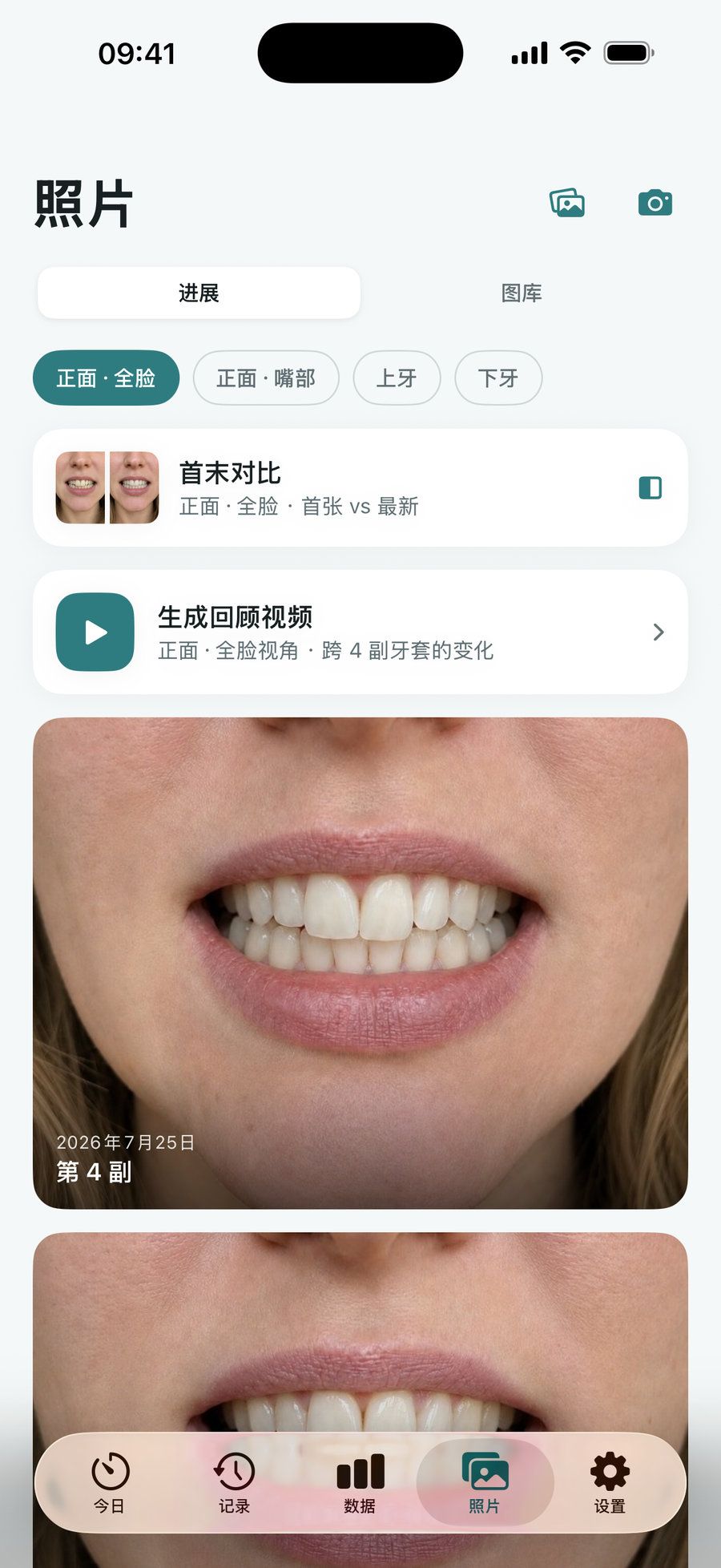 进度照片