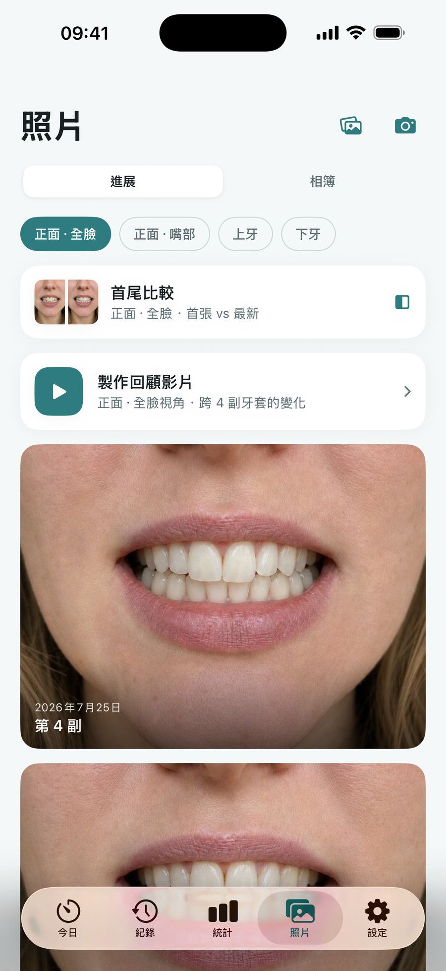 進度照片