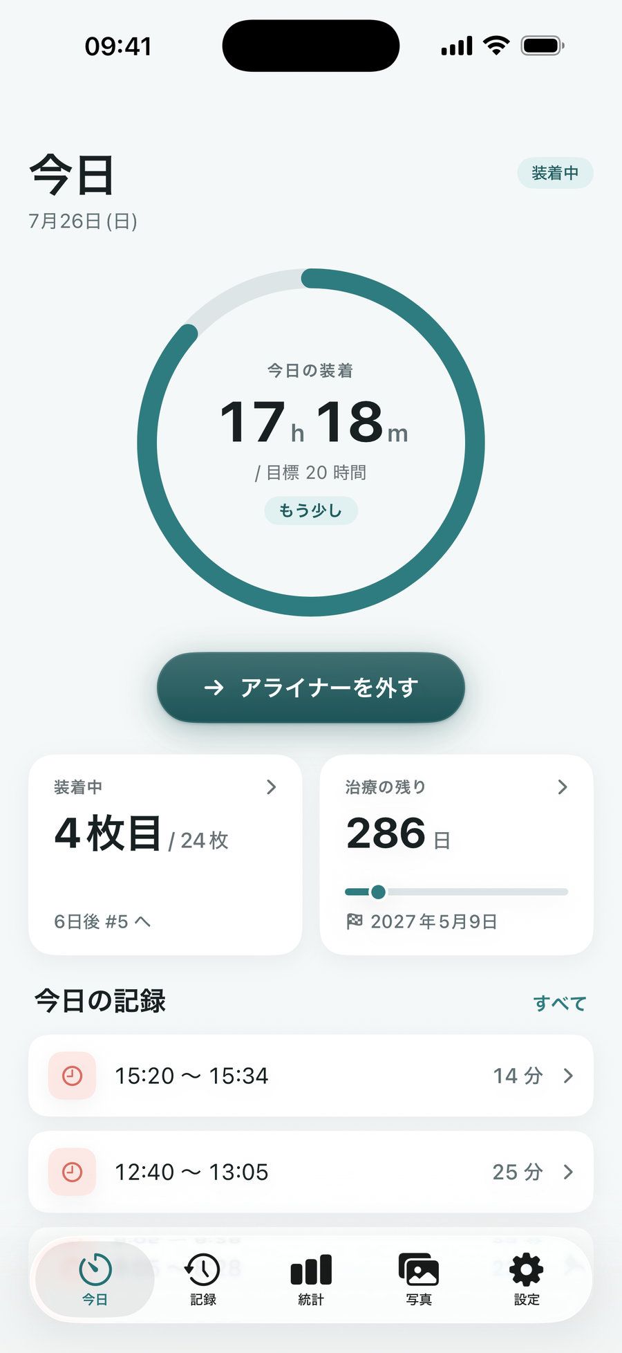 AlignDay の今日画面：装着時間リングが目標 20 時間に対して本日 17 時間装着を表示