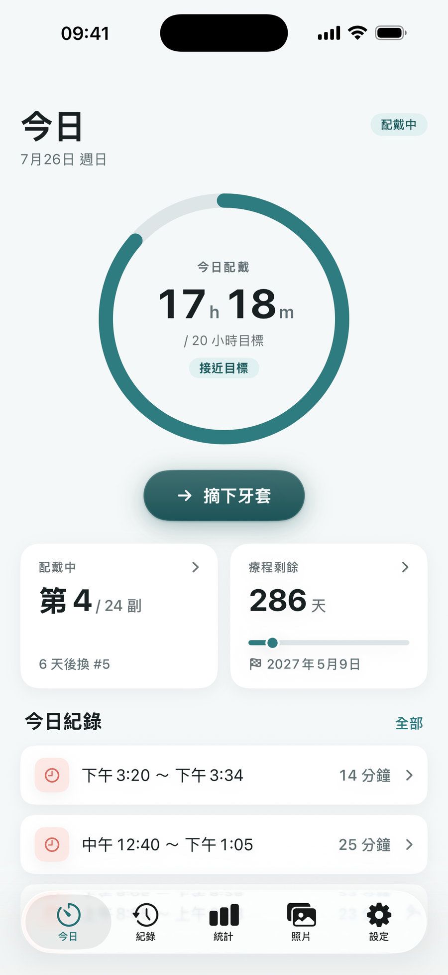 AlignDay 今日畫面：配戴時數進度環顯示今天已戴 17 小時，每日目標 20 小時