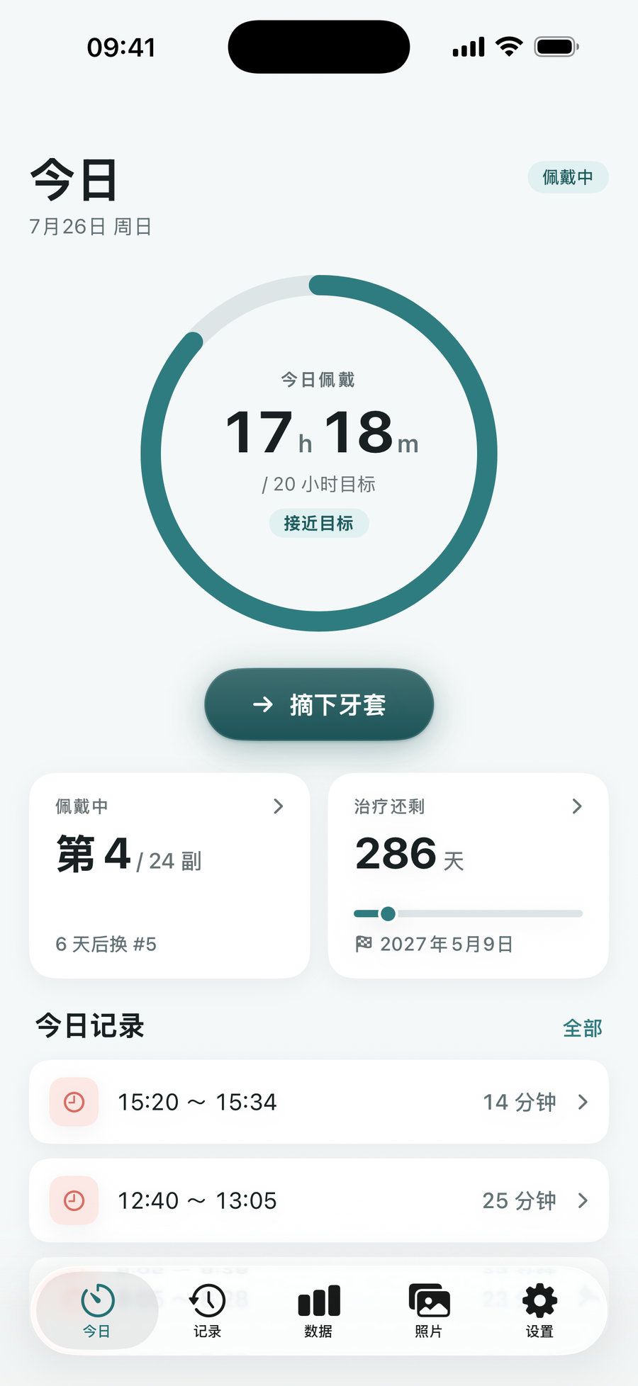AlignDay 今日页面：佩戴时长进度环显示今天已佩戴 17 小时（目标 20 小时）
