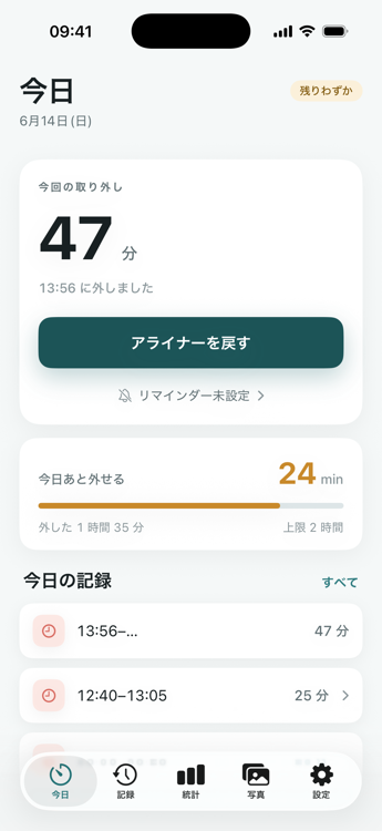 取り外し予算